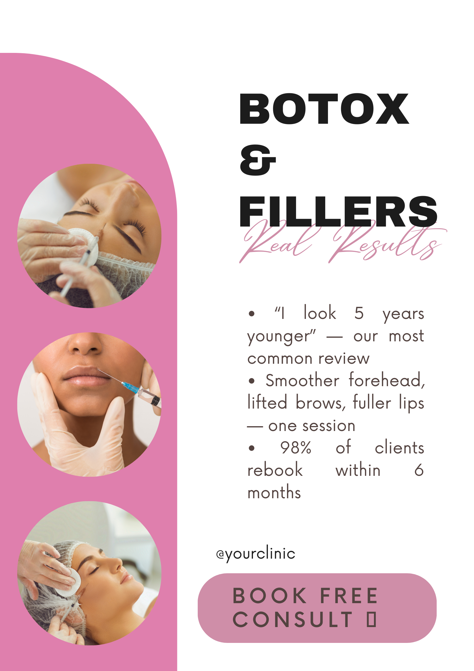 Botox & Fillers – Real Results